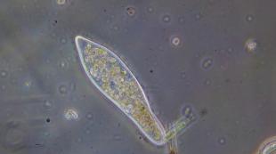 Reproduction of ciliates-shoes