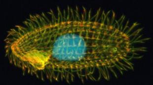 Koje organele kretanja protozoa imaju fibrile?